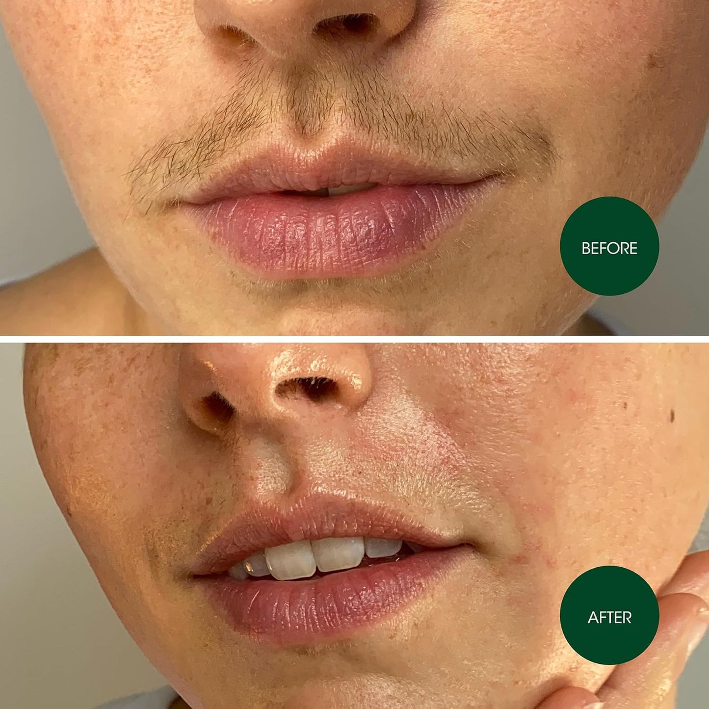 Facial Wax Strips for Facial Hair Removal