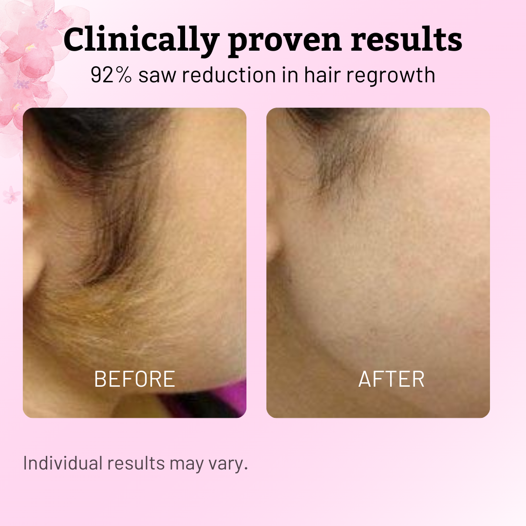 Cyperus Rotundus Hair Regrowth Control Oil