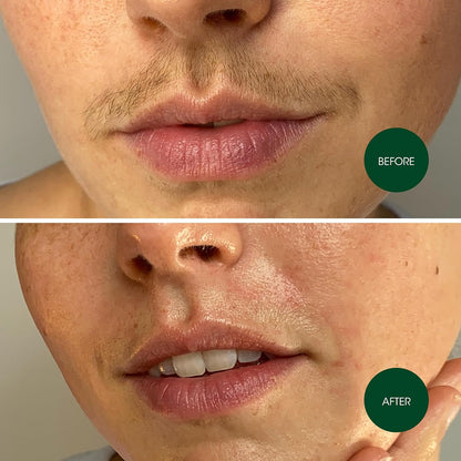 Facial Wax Strips for Facial Hair Removal