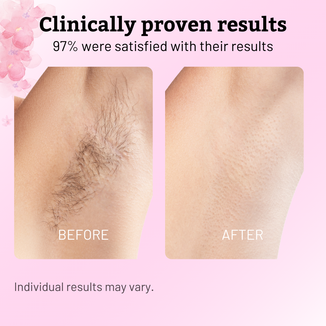 Cyperus Rotundus Hair Regrowth Control Oil