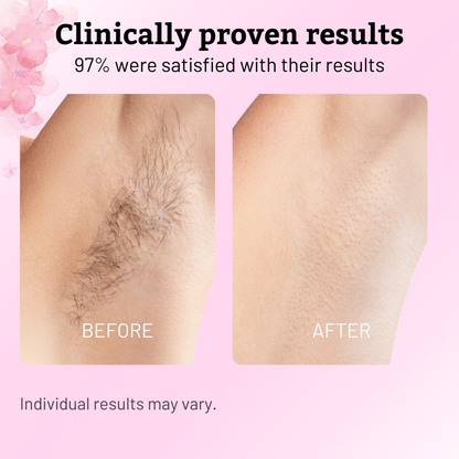 Cyperus Rotundus Hair Regrowth Control Oil