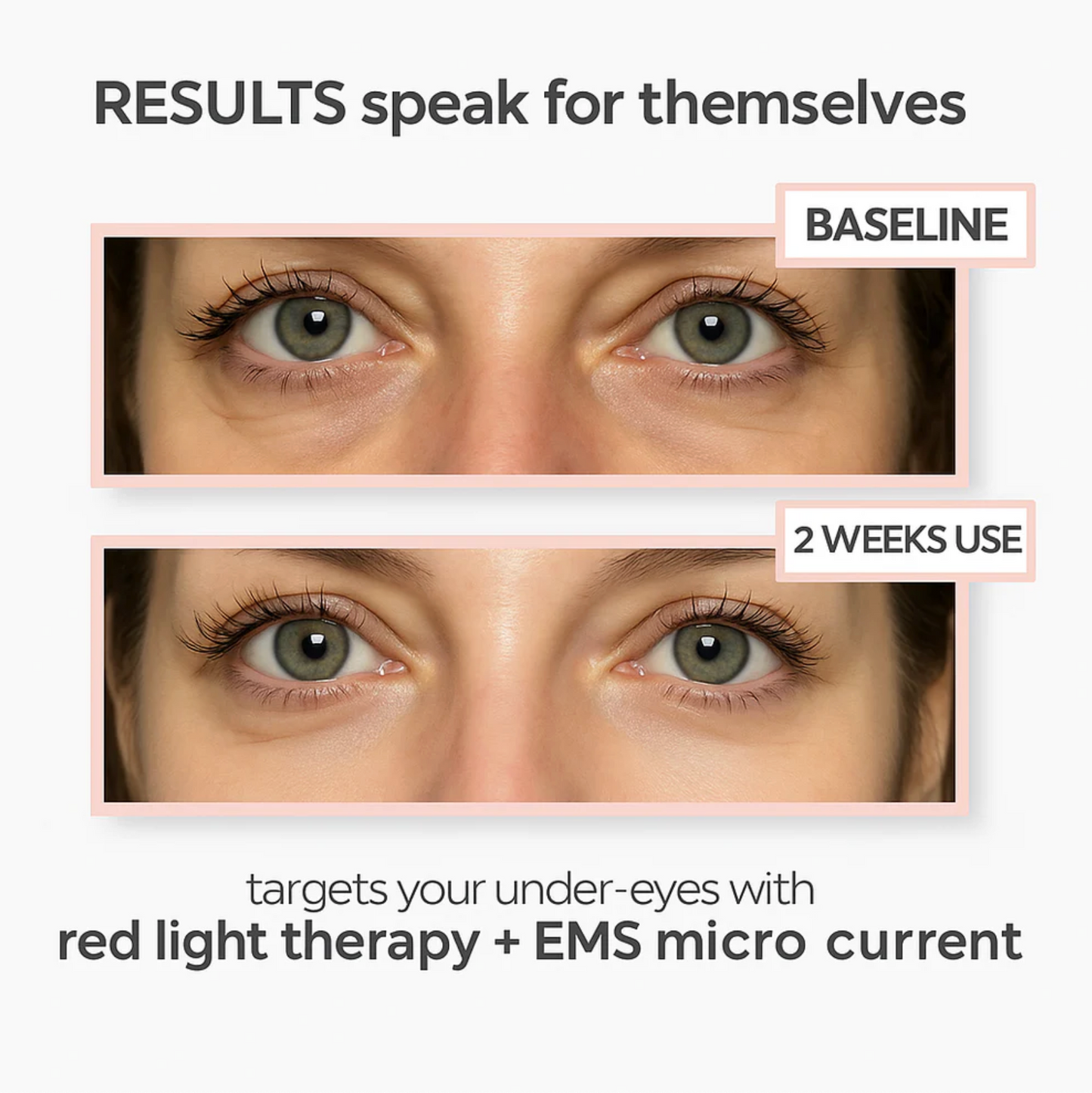 EInuvo™: Red Light Therapy That Deflates Eye Bags